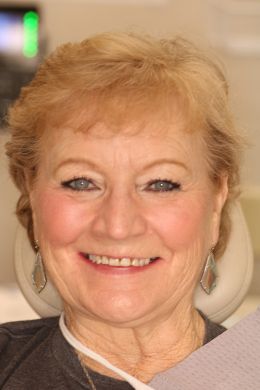 Belpree Dental | Crowns  amp  Caps, Implant Dentistry and Digital Impressions