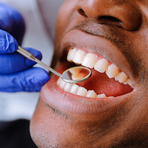 Cosmetic Dental Office Amarillo
