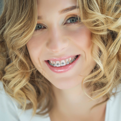 Belpree Dental | Dental Cleanings, Orthodontics and Dental Fillings