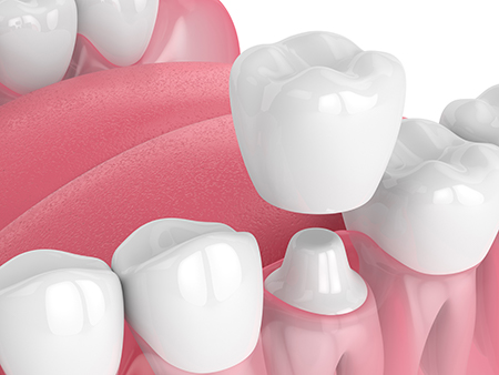 Belpree Dental